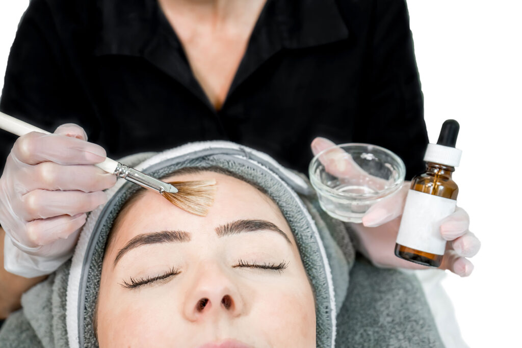 Unveiling the Magic of Chemical Peels at Hopkinton Skin Care