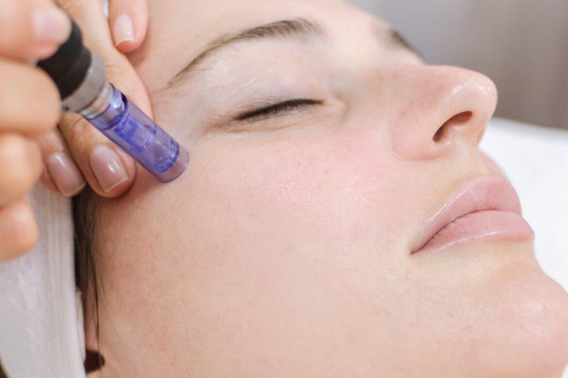 Microneedling device and treatment