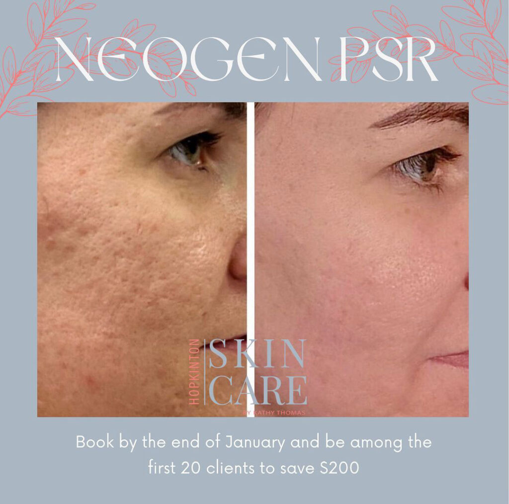 NeoGen PSR: A Holistic Approach to Skin Transformation