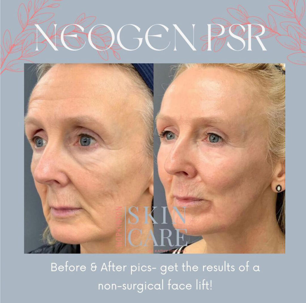 NeoGen: The Holistic Approach to Regenerating Your Skin's Architecture