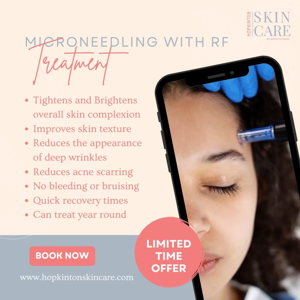 Micro-Needling with RF Treatment