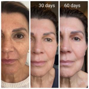 NeoGen Plasma in Hopkinton, MA