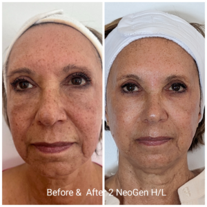 NeoGen Plasma in Hopkinton, MA